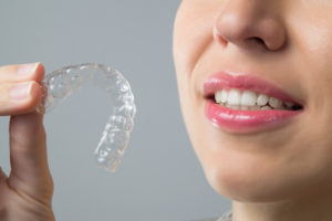 Invisalign clear braces